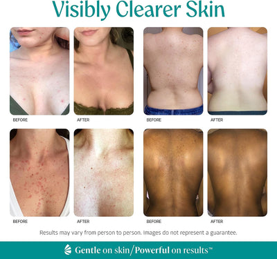 15% Mandelic Acid Exfoliating Serum