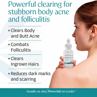 15% Mandelic Acid Exfoliating Serum